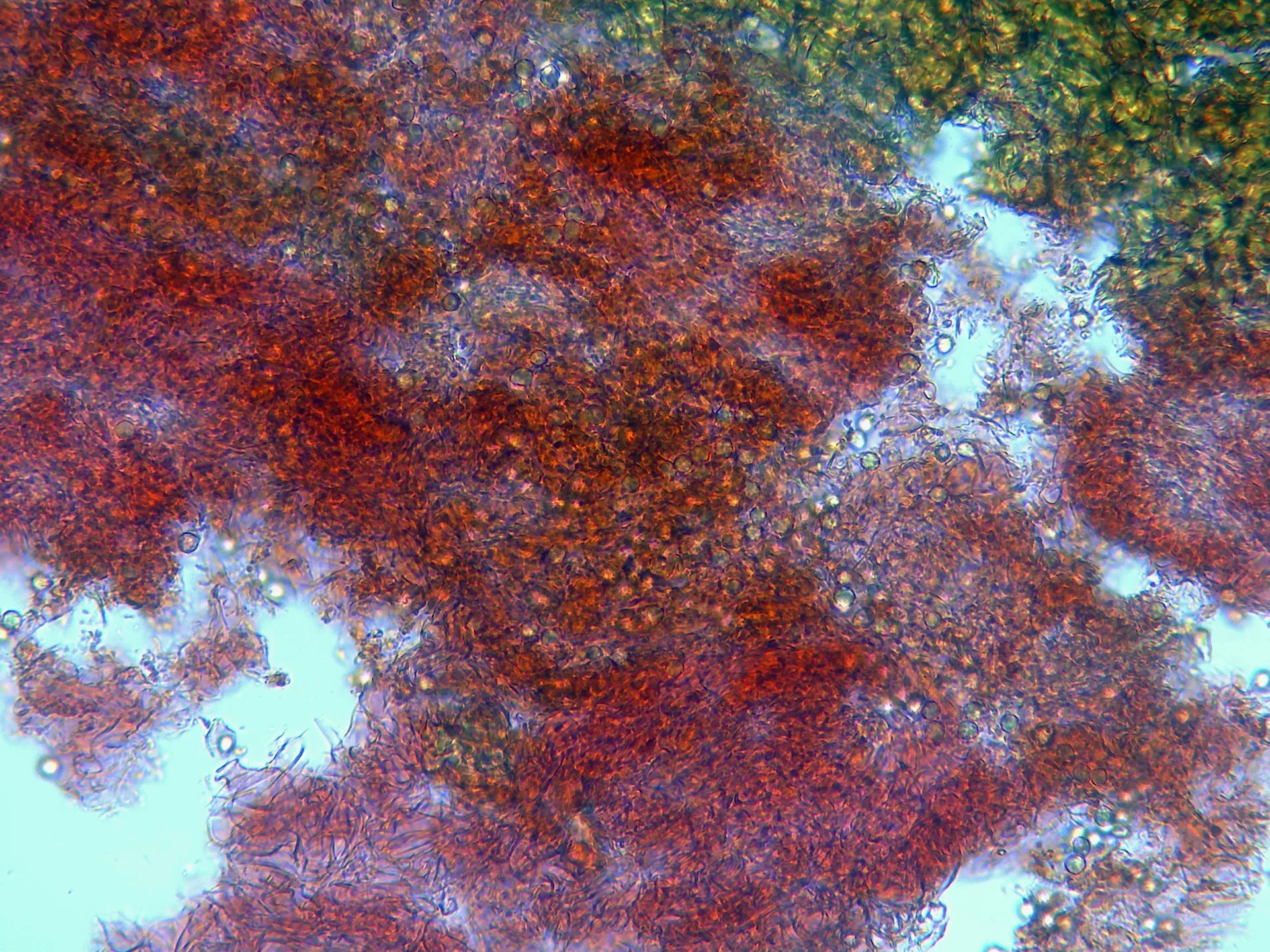 Microscopía de Sclerogaster compactus - 10 - Endoperidio x 400-001